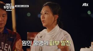 가수 <b>장윤정</b>, 10개월째 <b>건강 이상</b>…"피부 발진에 심신 모두 지쳐"