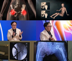 '<b>명의</b>' 노인 <b>고관절</b> 골절, 망설임이 위험한 이유