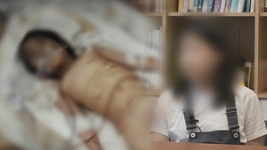 '<b>그것이 알고 싶다</b>' 44개월 의붓딸 사망 사건 추적, 자해인가 학대인가